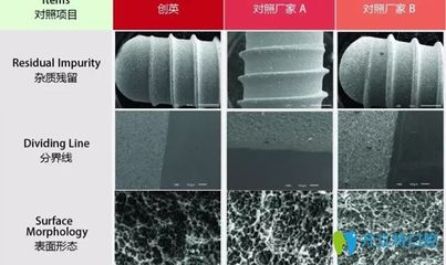 國(guó)產(chǎn)種植牙系統(tǒng)新星 創(chuàng)英種植牙系統(tǒng)的優(yōu)勢(shì)與研究所技術(shù)實(shí)力解析